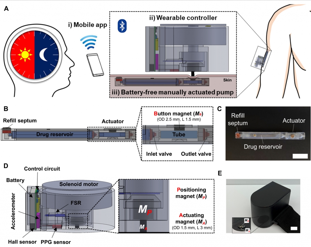 Implantable System for Chronotherapy.