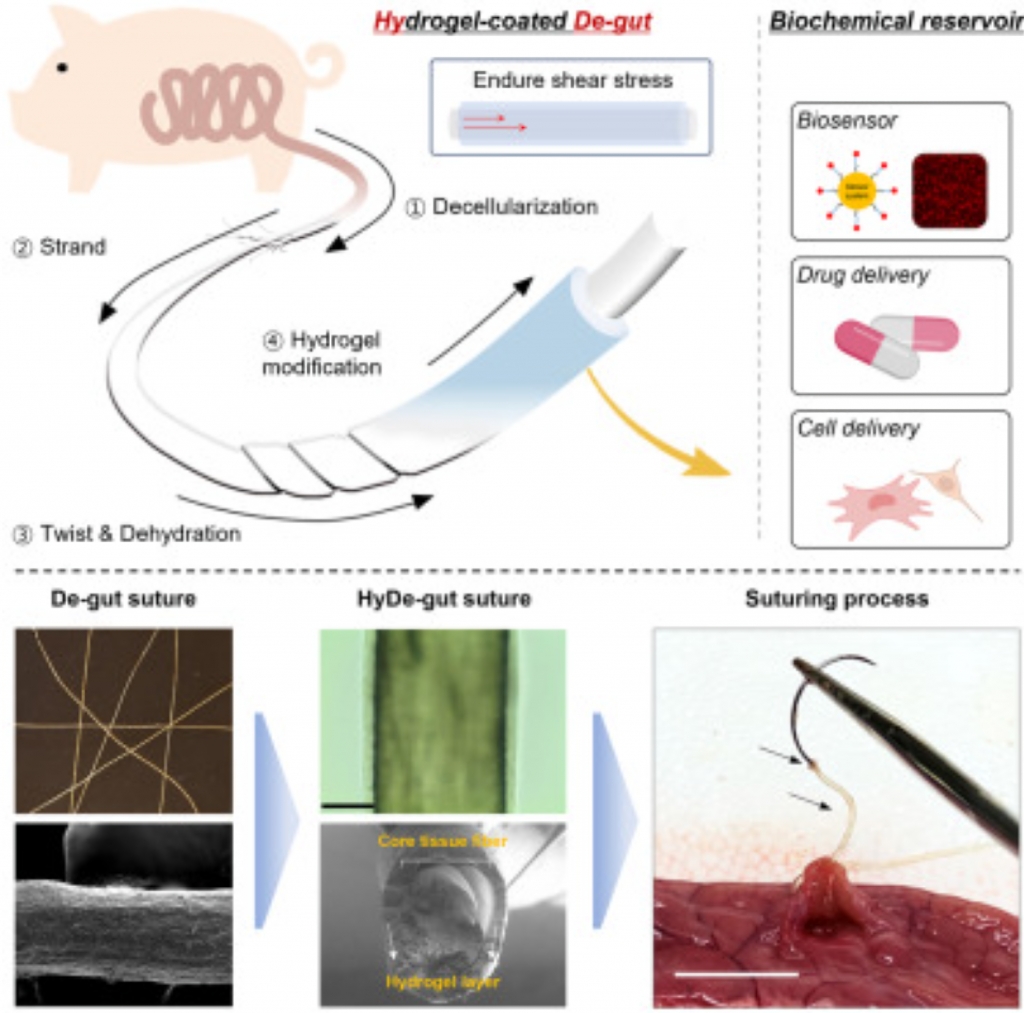 A Multifunctional Decellularized-Gut Suture Platform