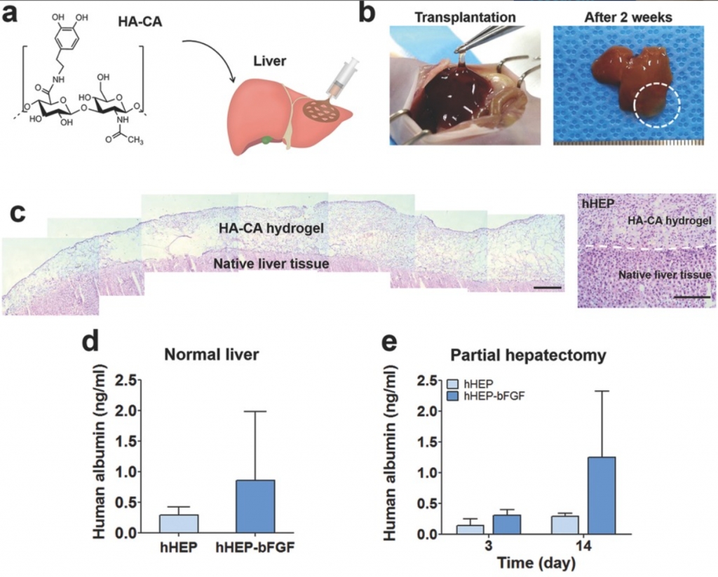 Tissue Adhesive Catechol-Modified Hyaluronic Acid Hydrogel for Effective, Minimally-Invasive Cell Therapy.